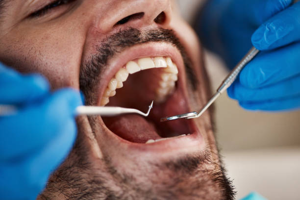 Best Tooth Pain Emergency Relief  in Greentown, IN